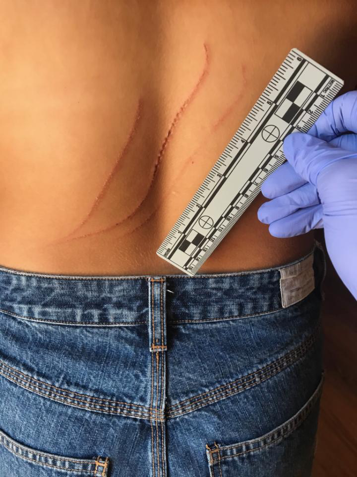 Bear that Attacked Woman Humanely Euthanized
